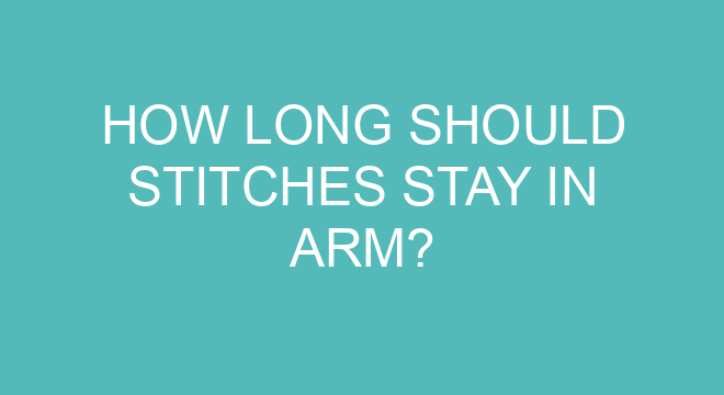 how-long-should-stitches-stay-in-arm